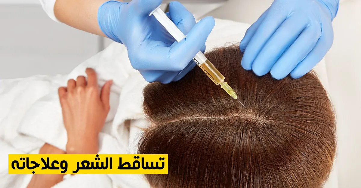 تساقط الشعر وعلاجاته